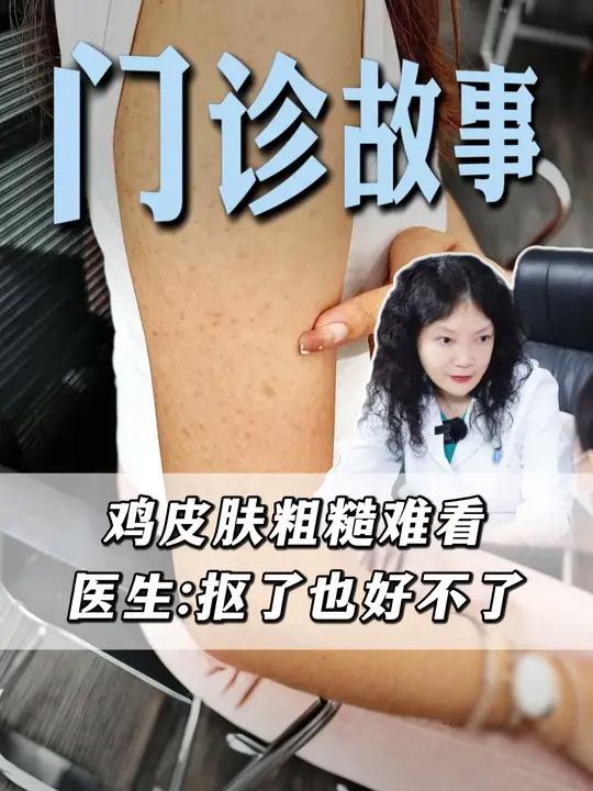 停！别再抠手臂上的#鸡皮肤 了！听医生教你怎么解决？#鸡皮疙瘩 #毛周角化 #变美 #叶主