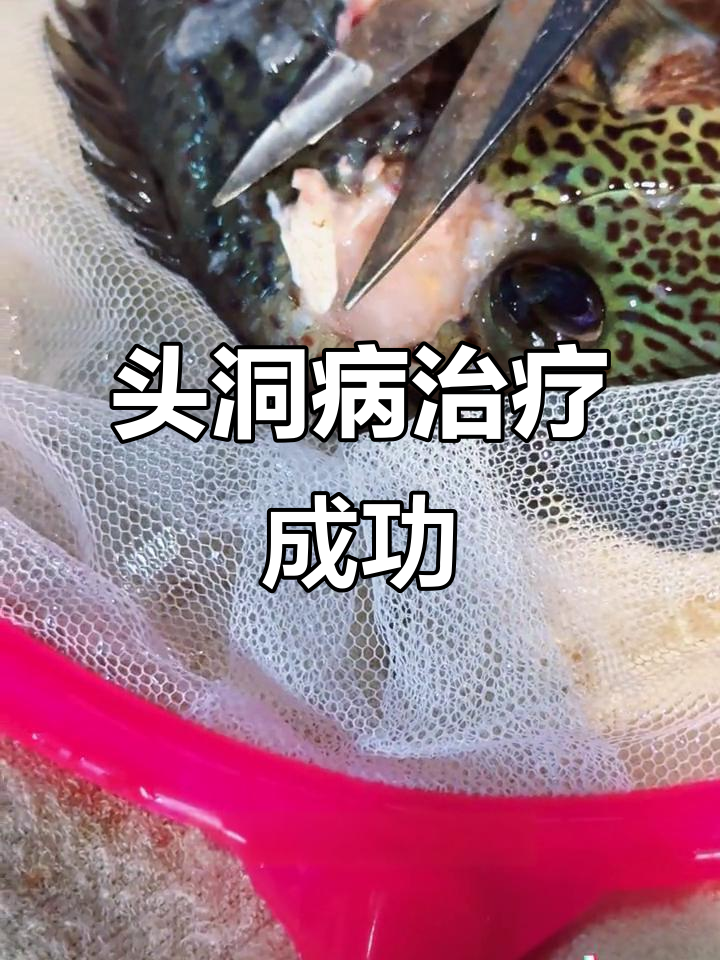 24年得头洞病，25年才治愈，恢复过程惊心动魄