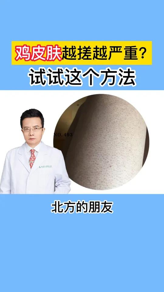 夏天到了,胳膊大腿的鸡皮疙瘩很难看,教你这个方法
