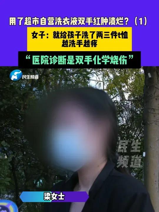 10月24日(发布)河南郑州,用了超市自营洗衣液双手红肿溃烂?女子:就给孩子洗了两三件t恤