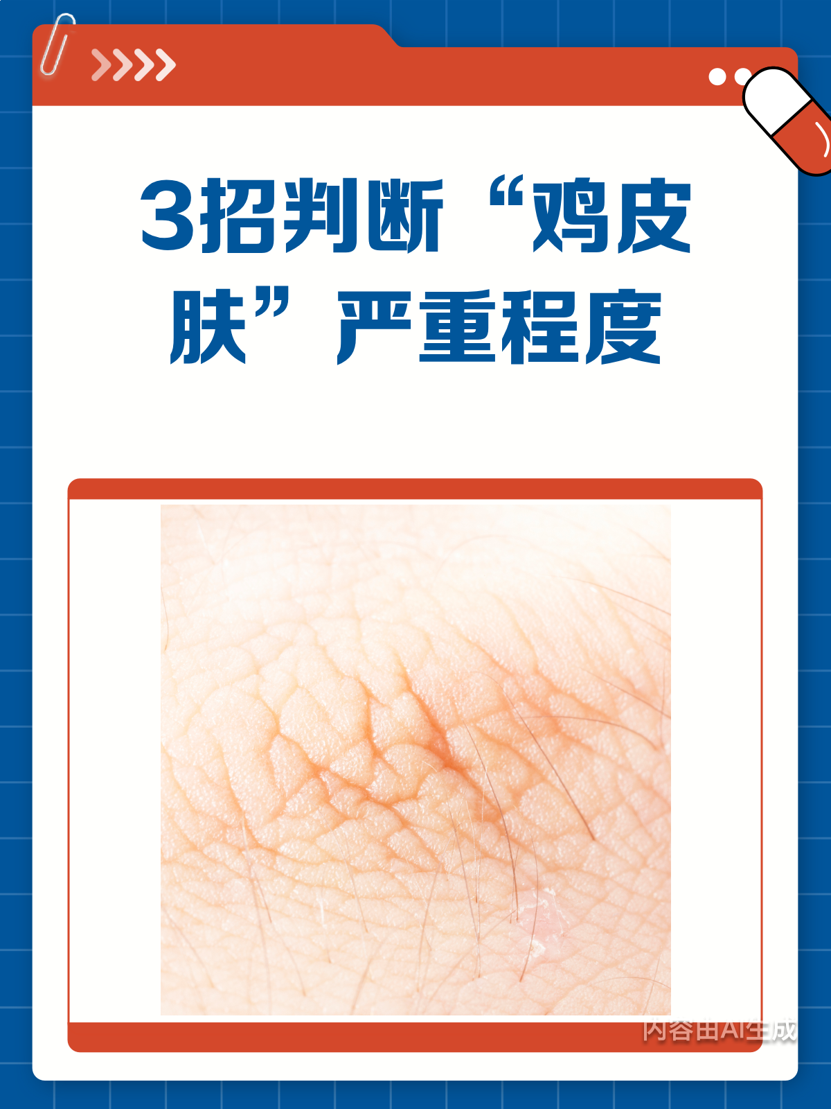 3招判断“鸡皮肤”严重程度,你中招了吗