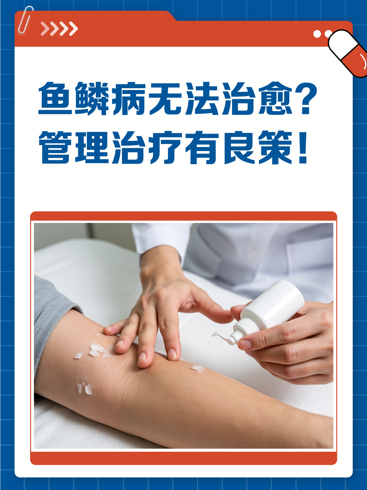 鱼鳞病无法治疗?真相在这里!