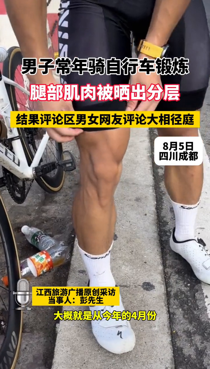 男子常年骑自行车锻炼,腿部肌肉被晒出分层
