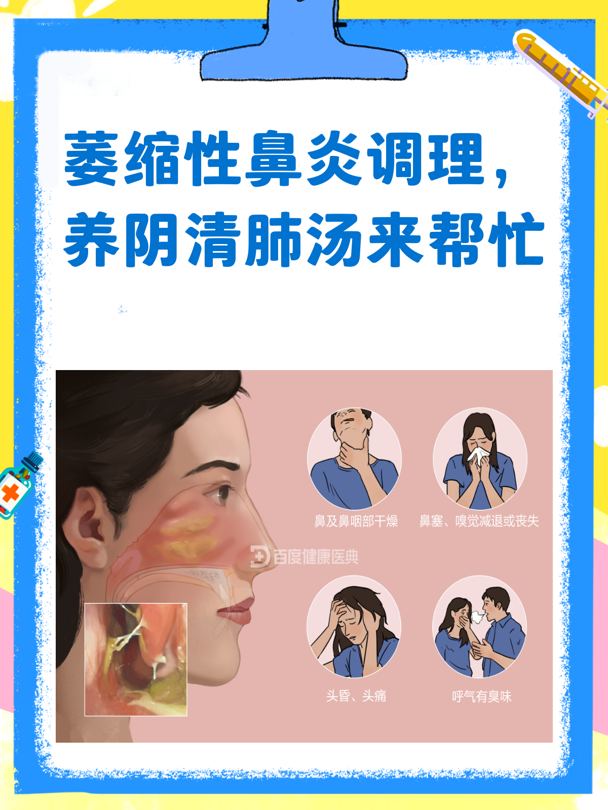 萎缩性鼻炎不用愁，养阴清肺汤来帮忙！