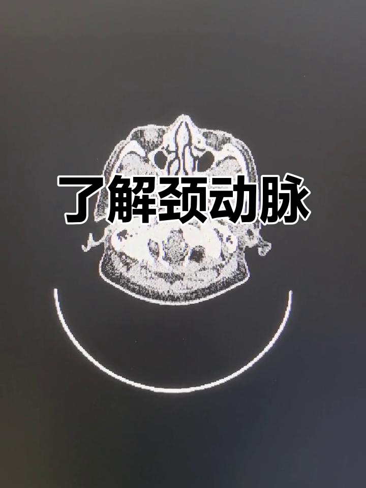 颈动脉解剖与功能详解