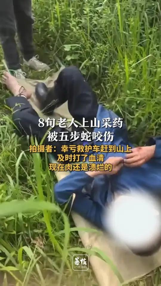 8旬老人上山采药被五步蛇咬伤 拍摄者:幸亏救护车赶到山上及时打了血清 现在肉还是溃烂的 近