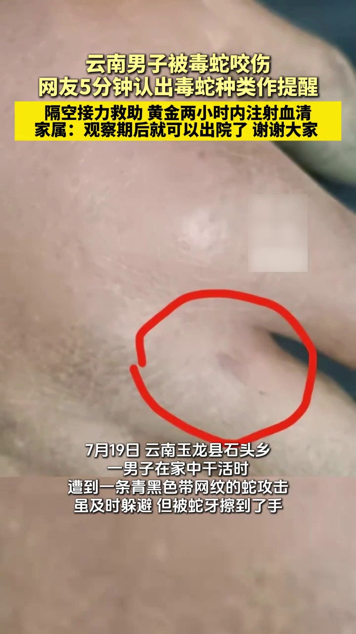 云南男子被毒蛇咬伤,网友5分钟认出毒蛇种类作提醒,隔空接力救回一命