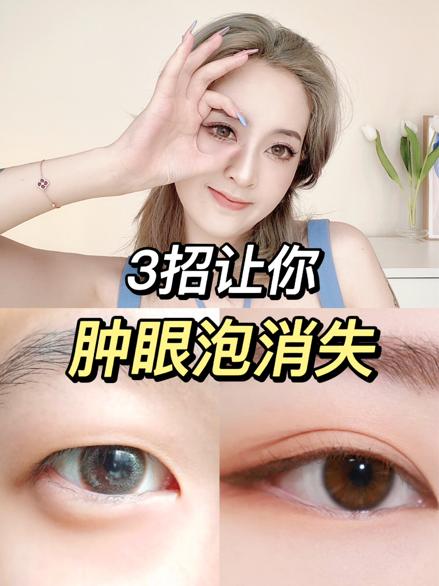 3个动作快速消除肿眼泡秒变双眼皮