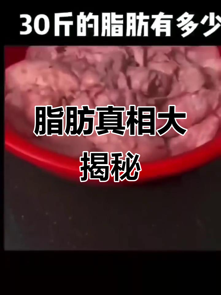 想要减肥?先看看这30斤脂肪,肚子里的“恐怖”真相!