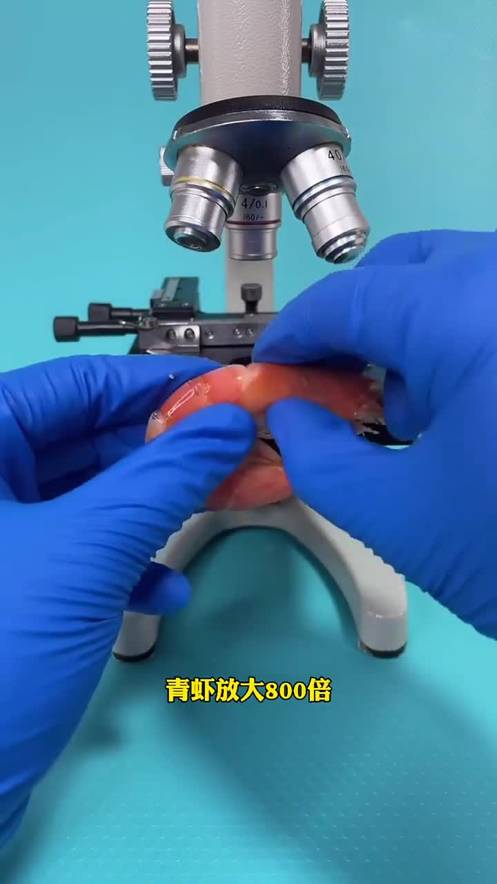 虾头真的有寄生虫吗?