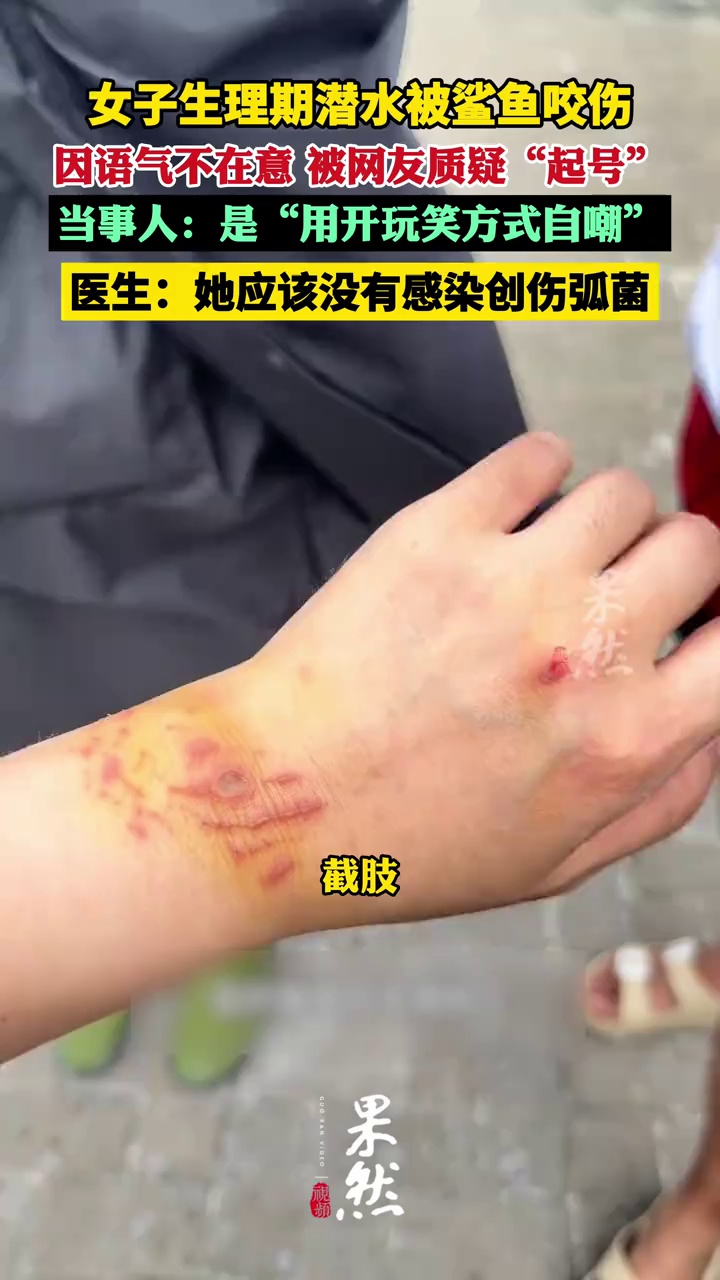 女子生理期潜水与鲨鱼群拍照时遭咬伤,被质疑“起号”炒作,当事人回应