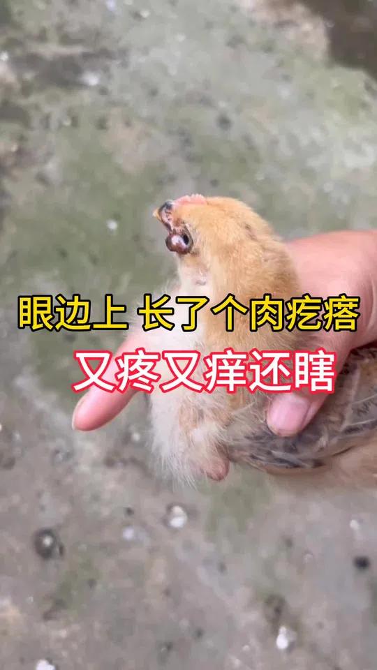 鸡眼边上长了个肉疙瘩,又疼又痒还瞎,咋回事