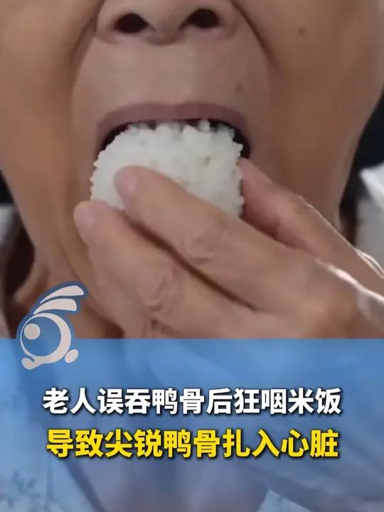 老人误吞鸭骨后狂咽米饭,导致4.5厘米长的尖锐鸭骨扎入心脏!