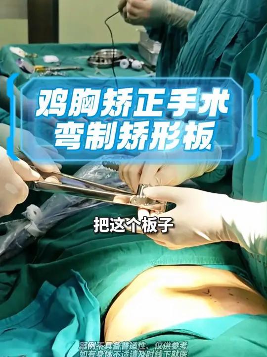 13岁男孩鸡胸矫正手术全记录,第3部分:弯制矫形板。鸡胸 漏斗胸 手术室日常