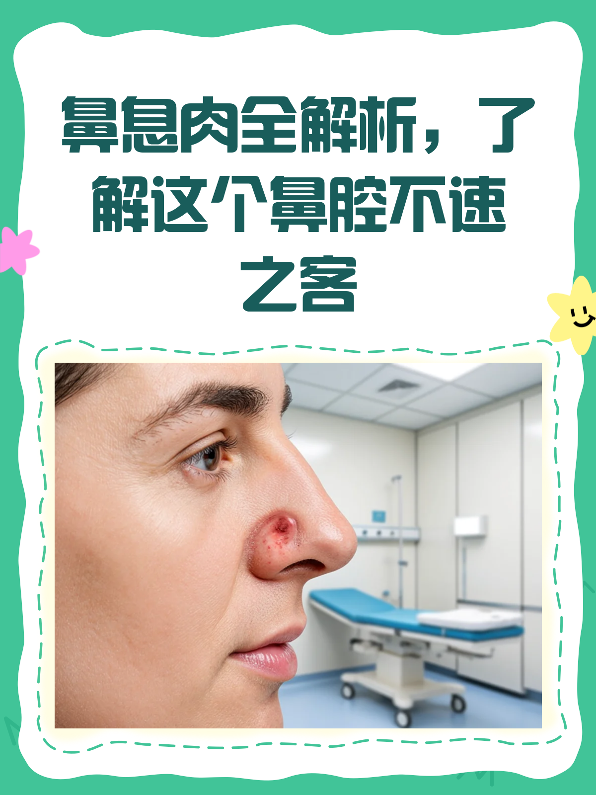 鼻息肉知多少?揭秘鼻腔里的“不速之客”!