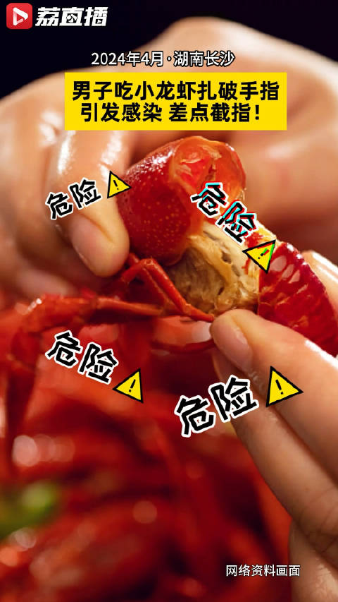 「太吓人!男子吃小龙虾被扎破手指险截指」近日,湖南长沙的谢先生吃小龙虾时手指被扎破流血,可