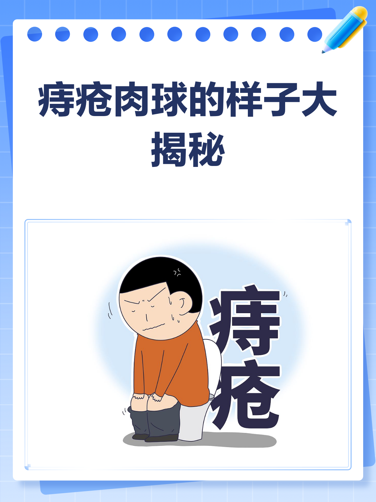 痔疮肉球长啥样?一文带你全面了解