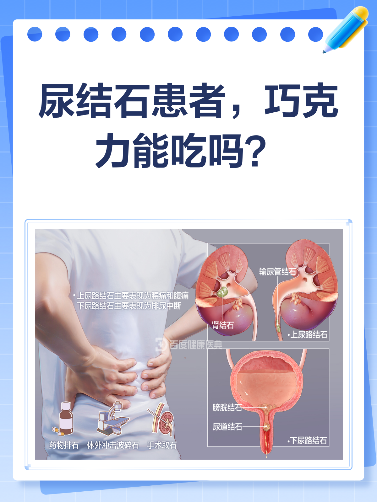 尿结石患者,巧克力真的不能吃吗?