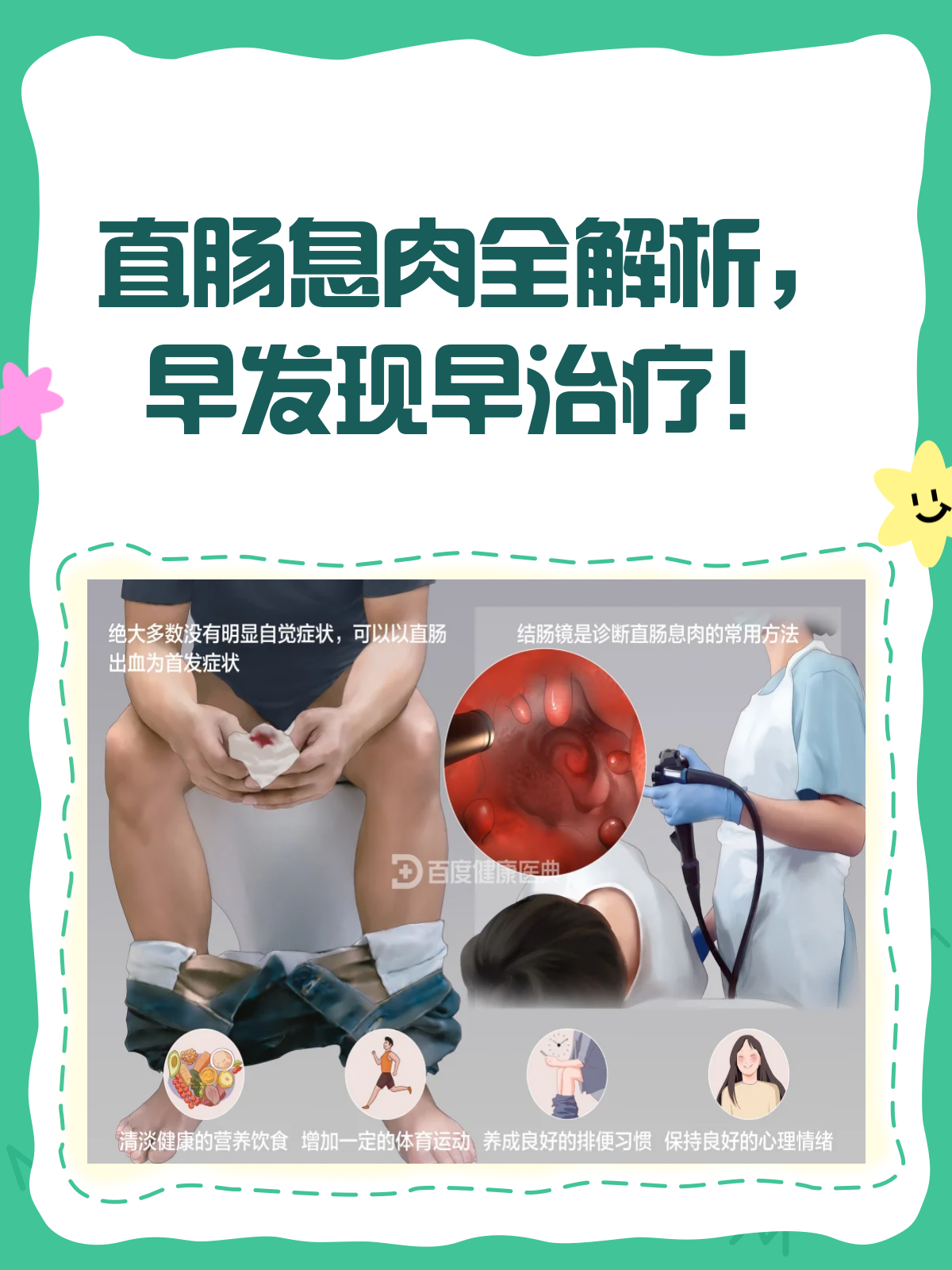 直肠息肉全解析,你真的了解它吗?