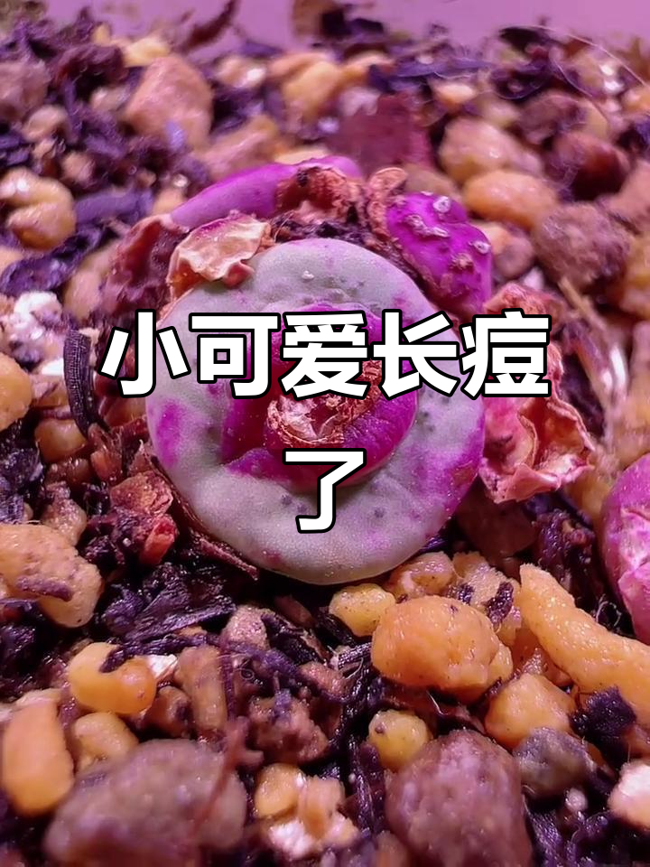 小红嘴怎么一脸痘痘?阳台多肉植物日常