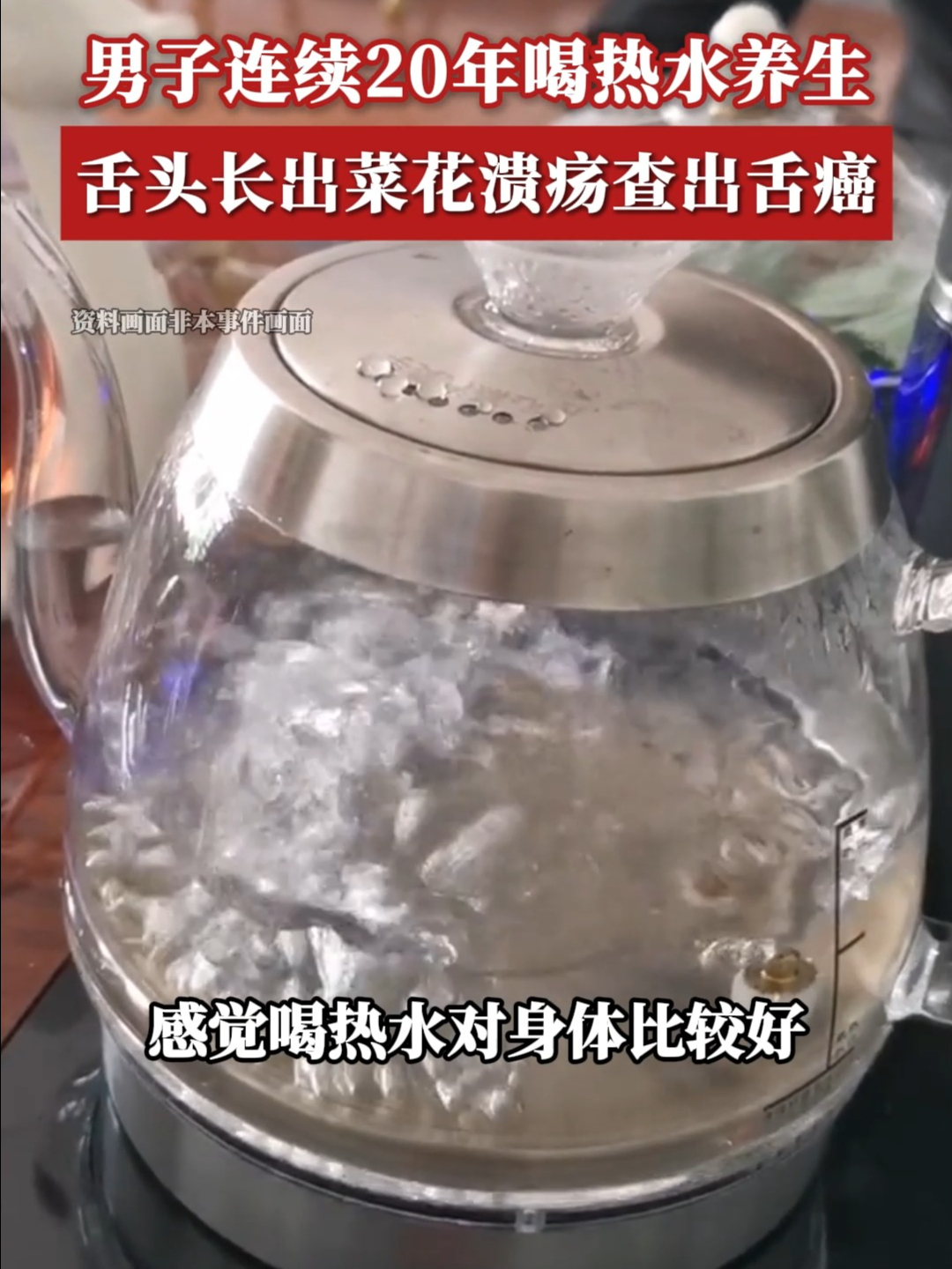 男子连续20年喝热水养生,舌头长出菜花溃疡查出舌癌