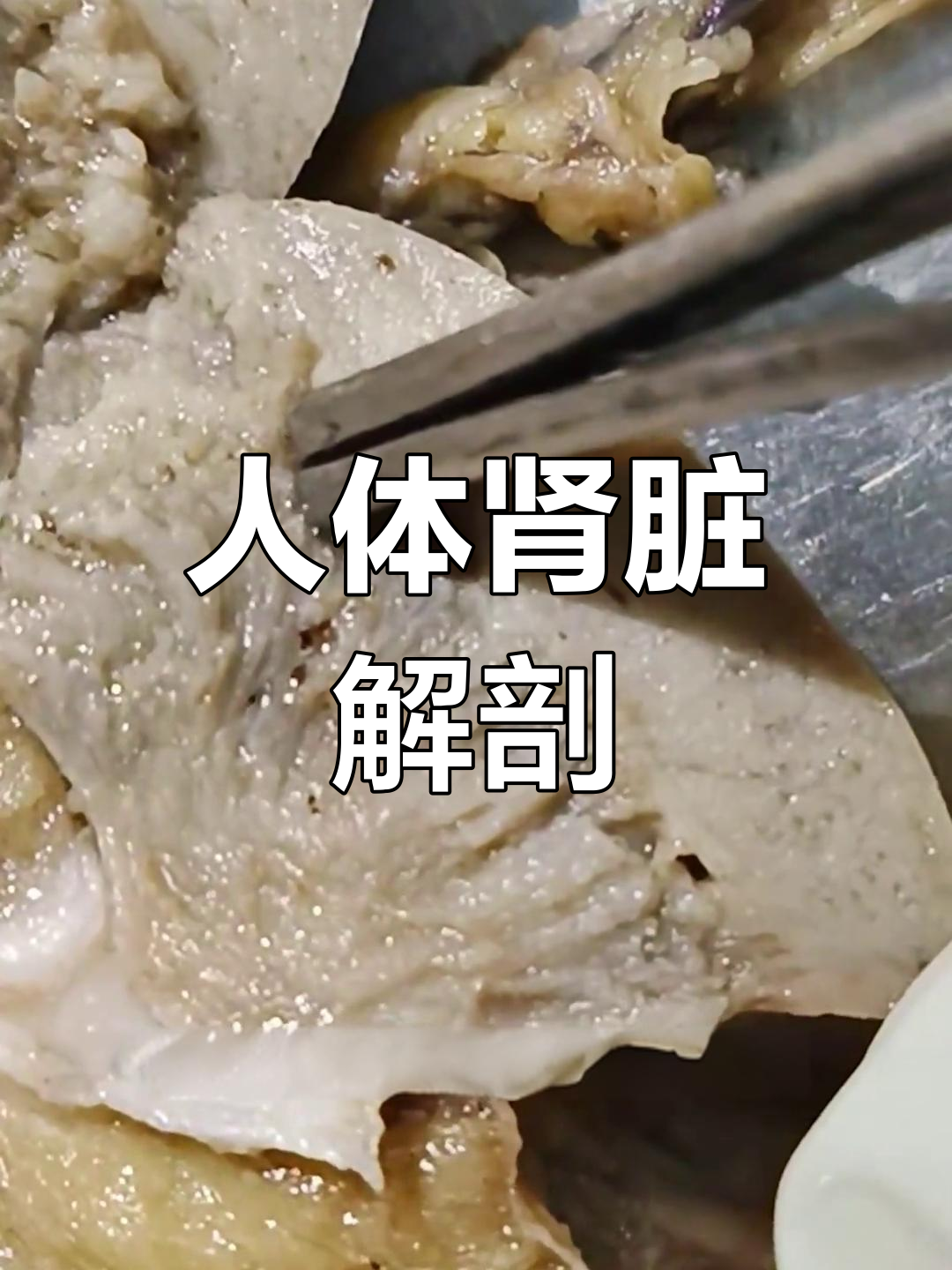 揭秘人体肾脏内部结构,了解肾小体与乳头的功能