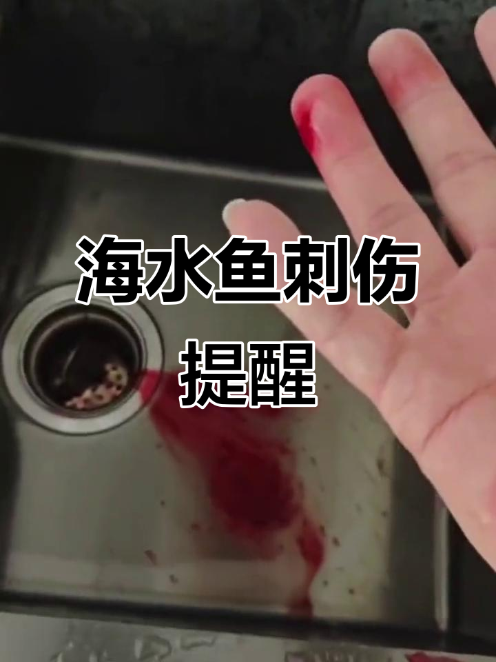 倒钓类海水鱼刺伤事件,新手玩家必看!