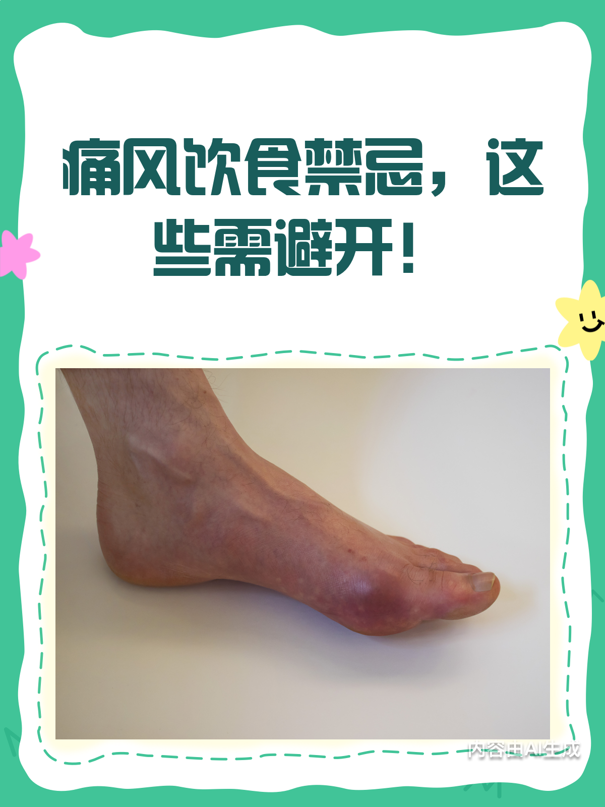 痛风患者,这些高嘌呤食物要少吃!