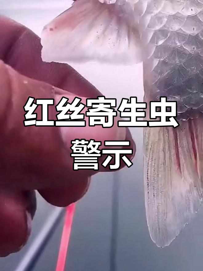 过年吃鱼,警惕红丝血管寄生虫!