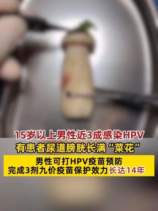 「#男患者感染hpv尿道膀胱长满“菜花”」医生建议:男性可打HPV疫苗预防,完成3剂九价疫