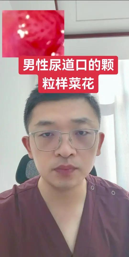 男性尿道口的菜花 