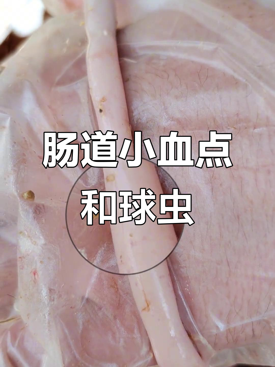 小肠球虫感染,肠道出血点明显