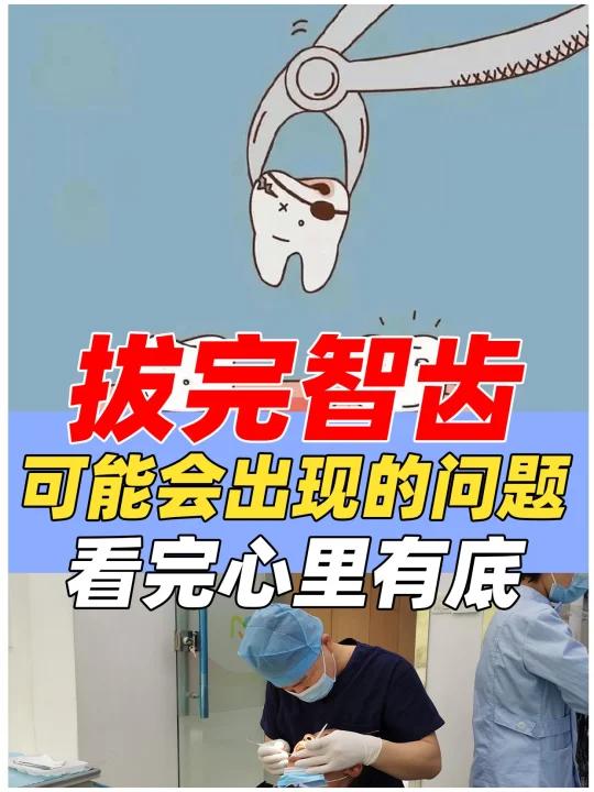 拔完智齿可能会出现这些问题,看怎么应付!