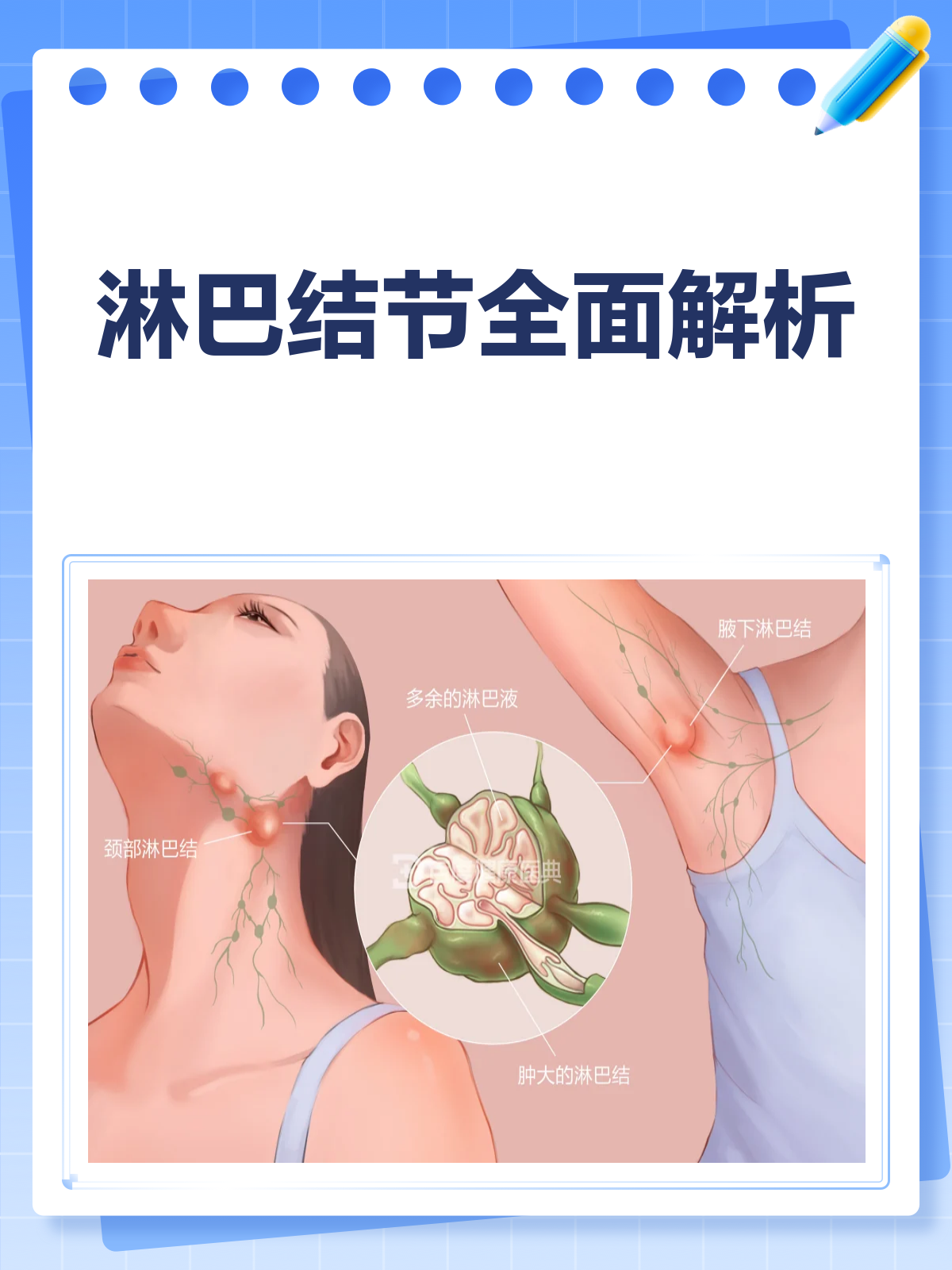 淋巴结节是什么?一文带你全面了解