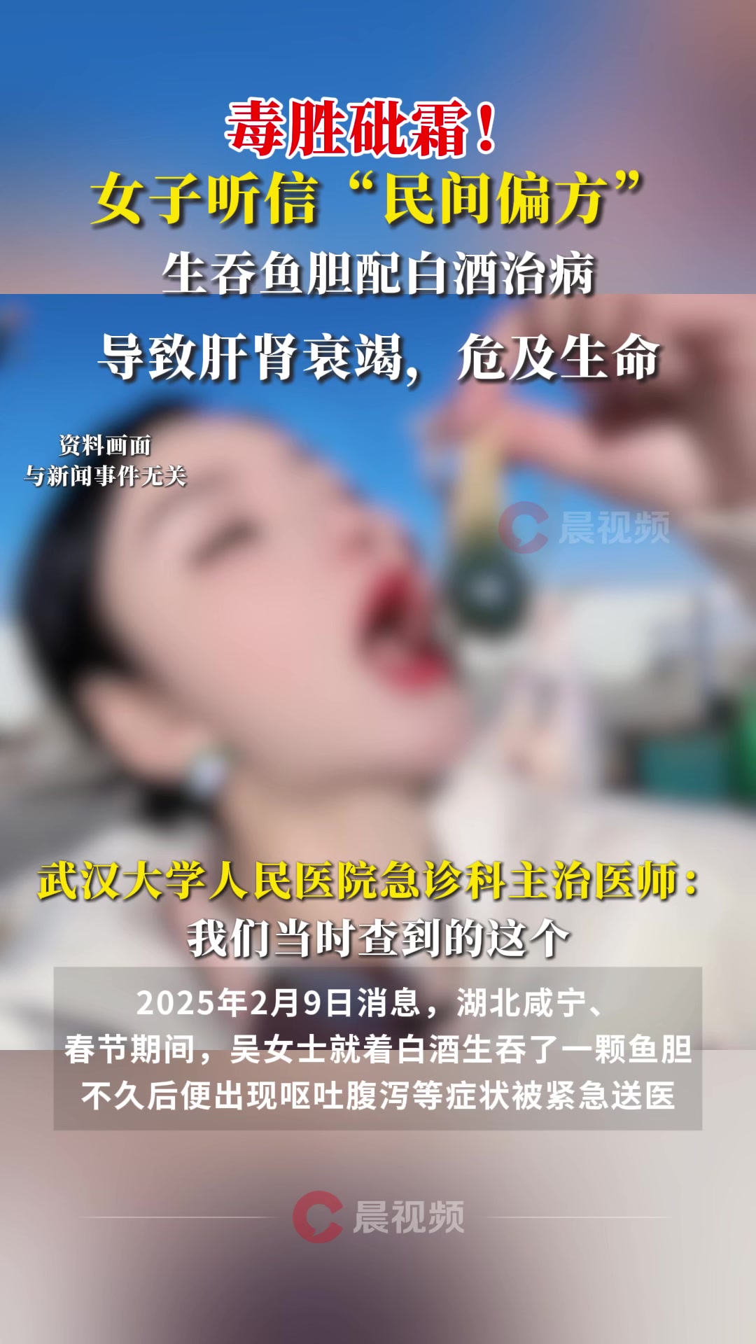 毒胜砒霜!女子听信“民间偏方”生吞鱼胆配白酒治病,导致肝肾衰竭,危及生命