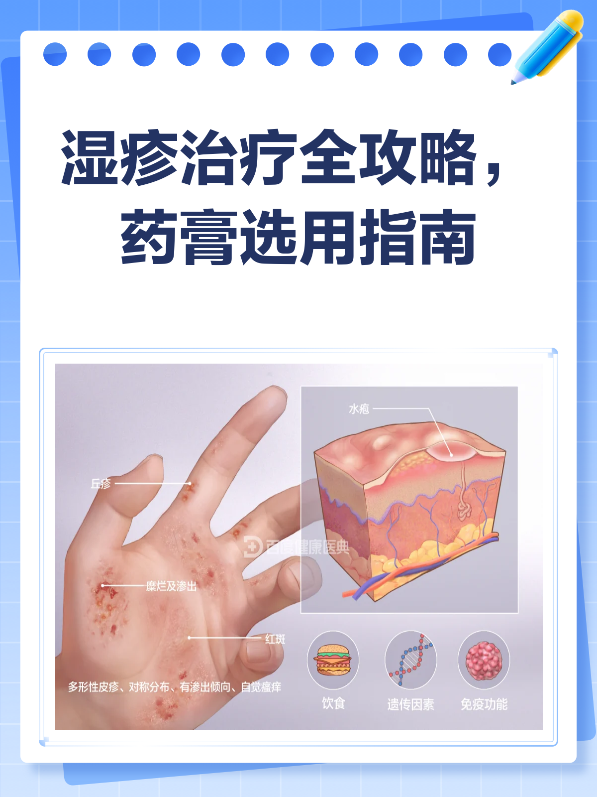 湿疹来袭不用慌，药膏选择有妙方！