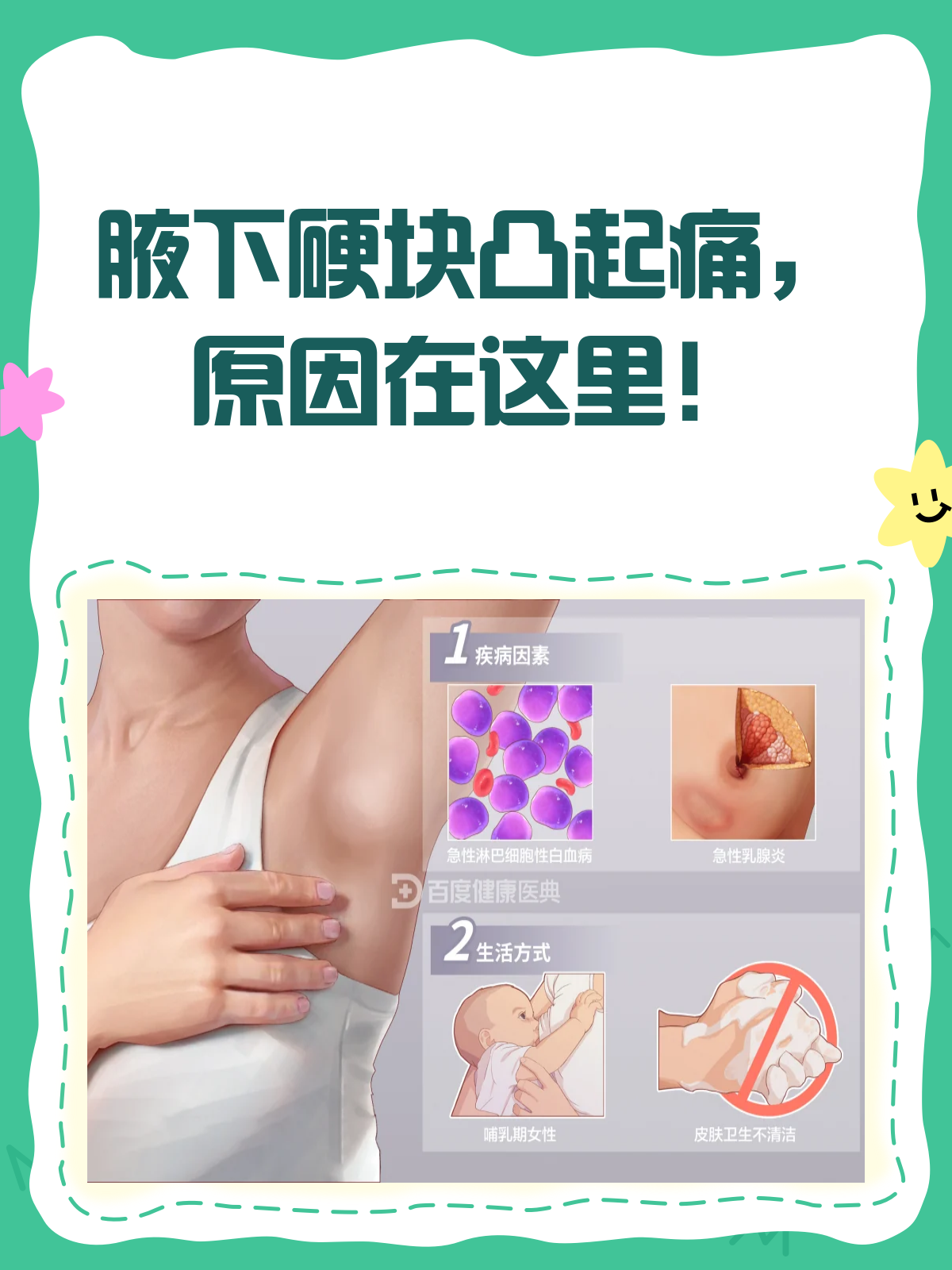 腋下硬块凸起还痛？快来看看咋回事！