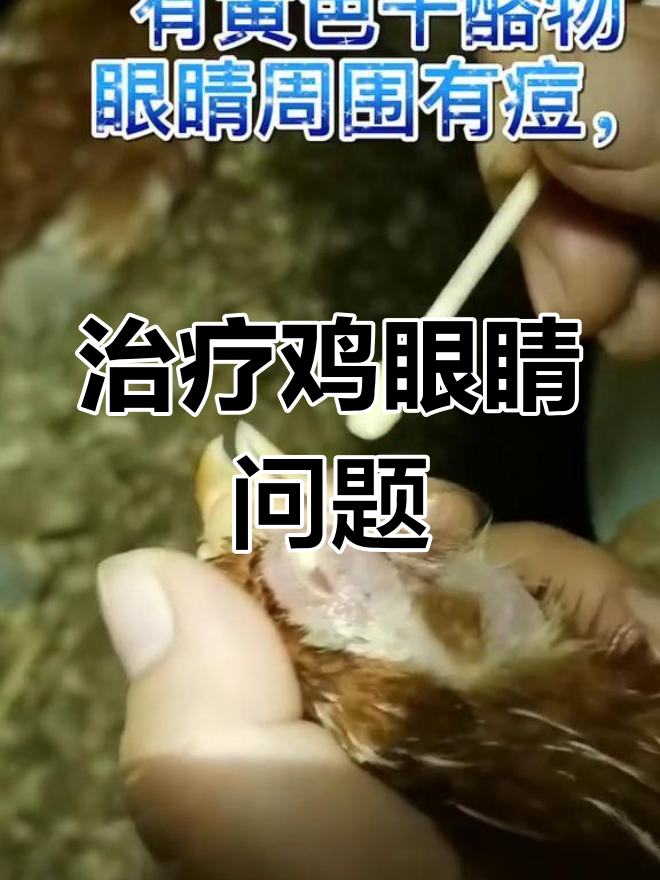 鸡眼流泪,黄色干浪物症状治疗