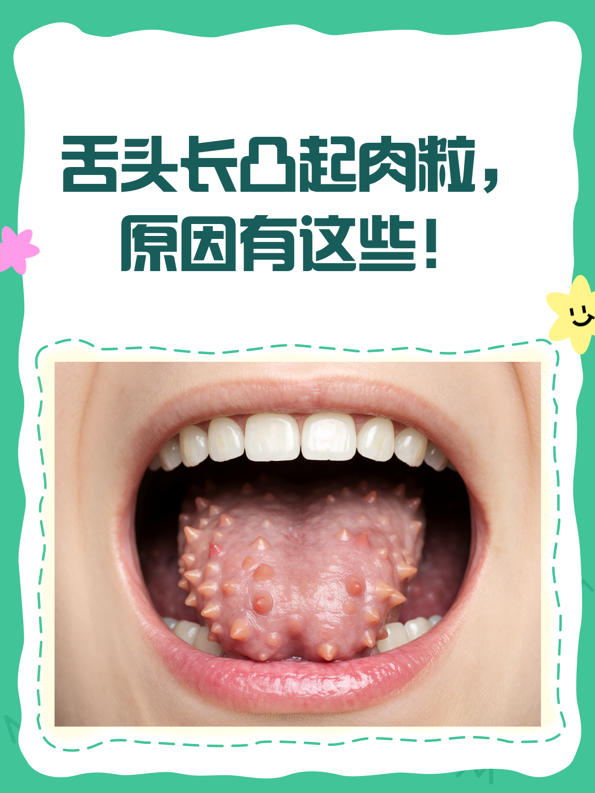 舌头里面长凸起肉粒？别慌，先来看看这个！