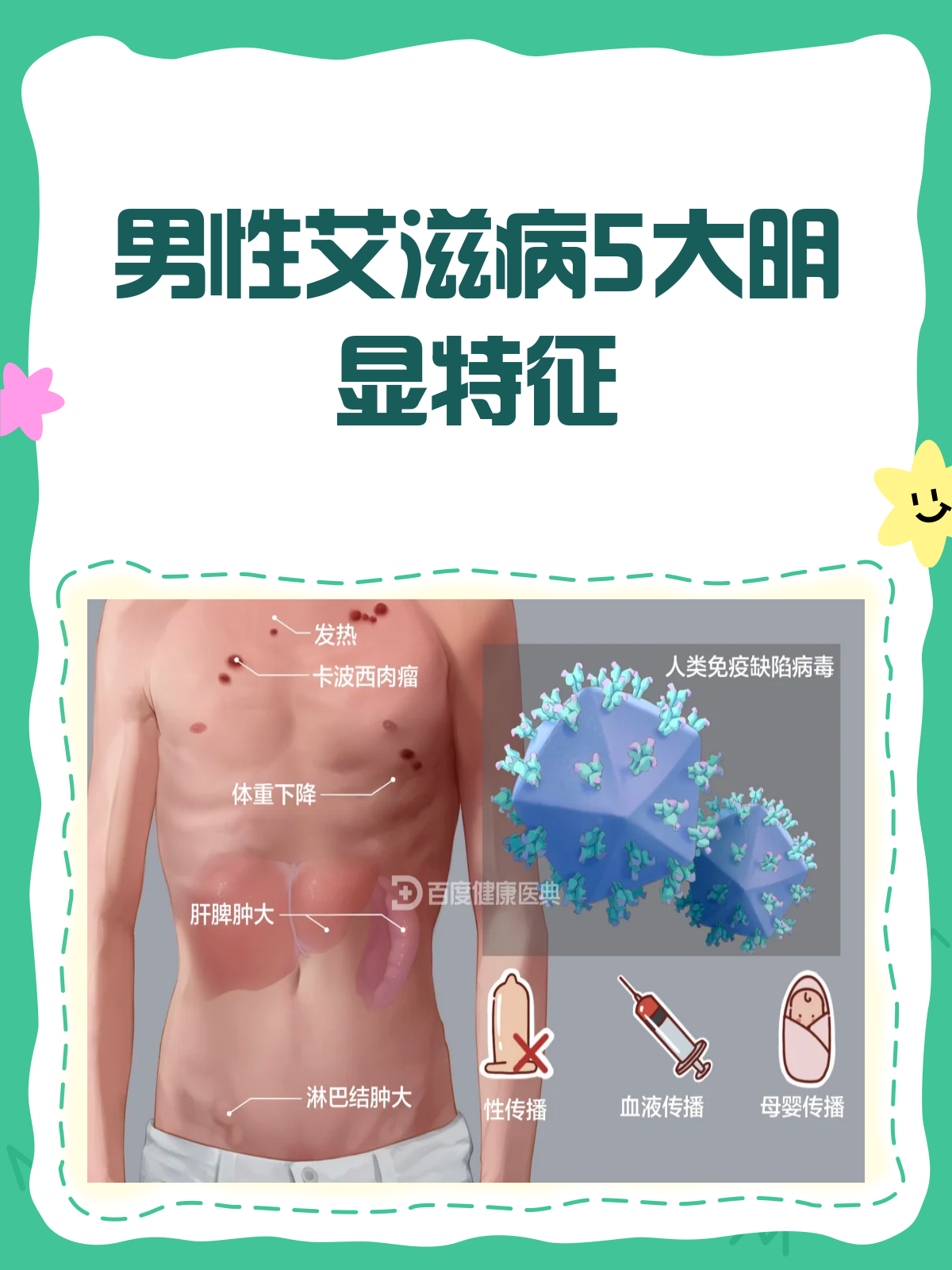 男人艾滋病最明显特征