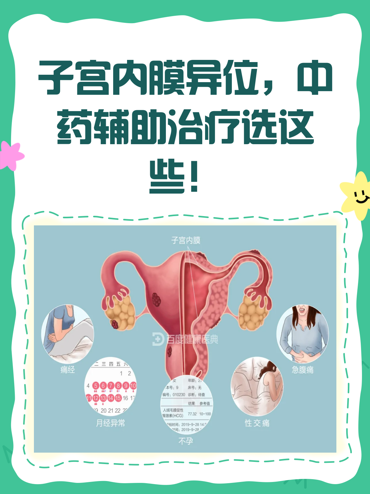 子宫内膜异位症中药辅助治疗全攻略!