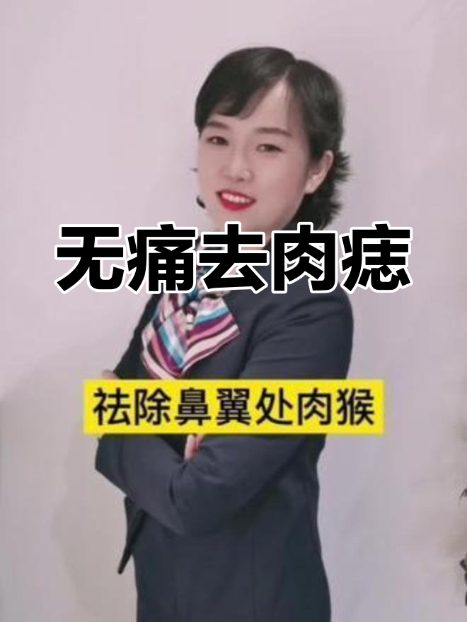 鼻翼肉痣无痛去除,效果显著