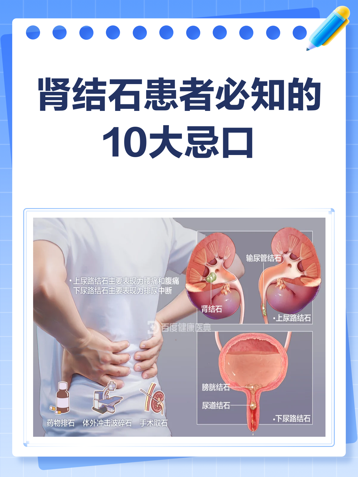 肾结石患者必看!这10类食物要少吃或不吃