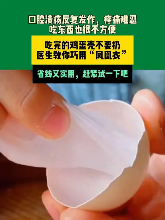 1月10日广东(发布)口腔溃疡反复发作,疼痛难忍,吃东西也很不方便,吃完的鸡蛋壳不要扔,医