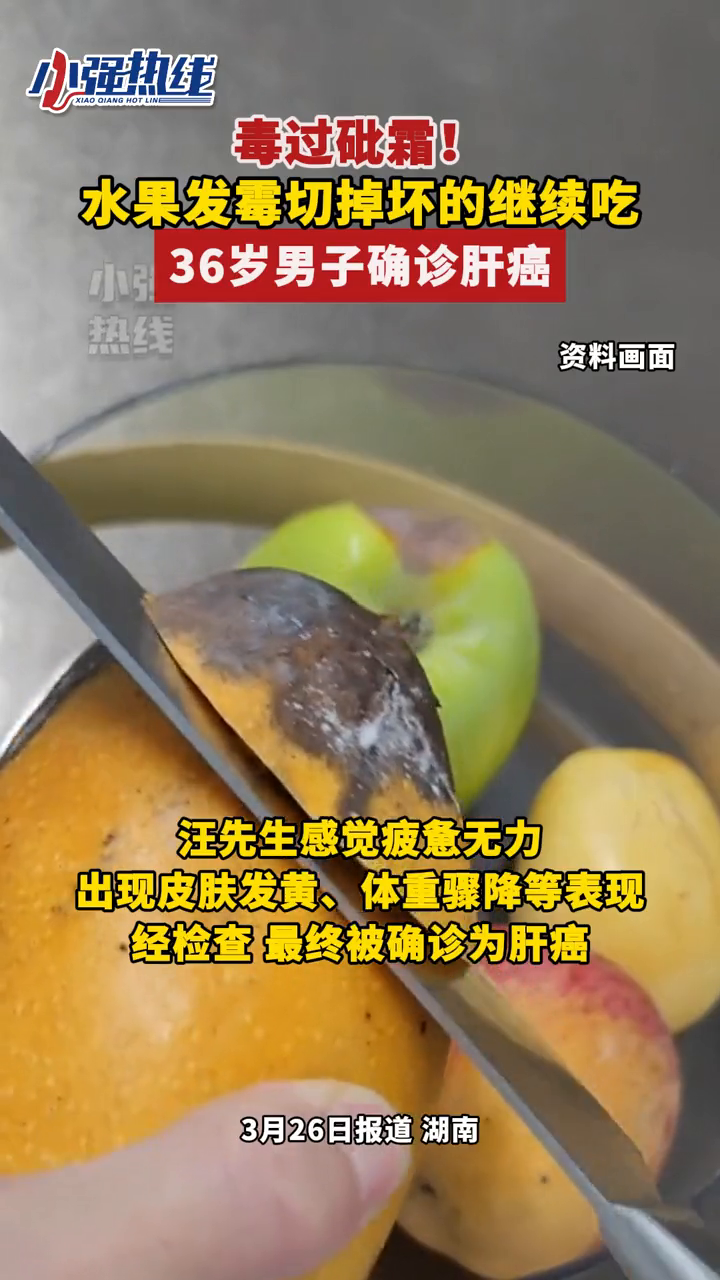 毒过砒霜!水果发霉切掉坏的继续吃,36岁男子确诊肝癌!