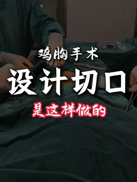 鸡胸手术设计切口位置,每一台手术都需要根据孩子胸壁畸形的具体情况设计手术方案。鸡胸 位创手