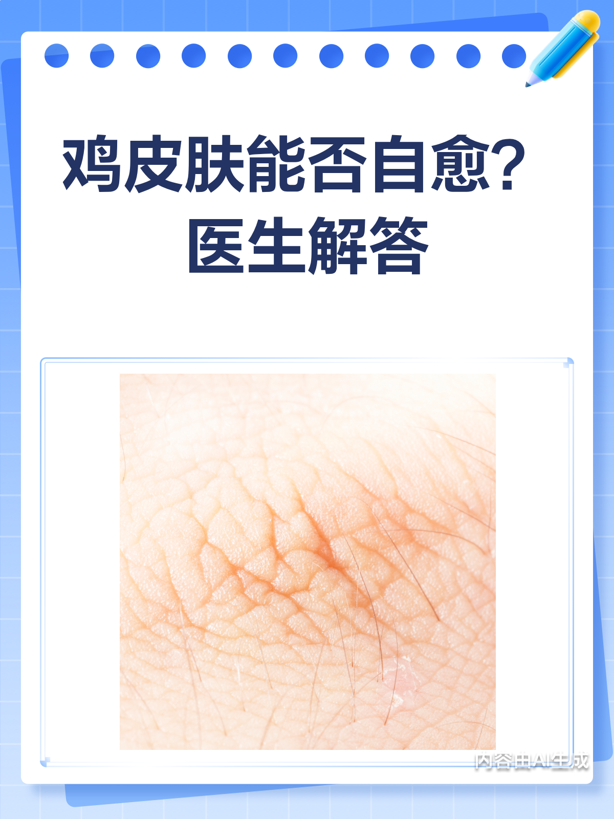 鸡皮肤能自愈吗?答案可能让你意外!