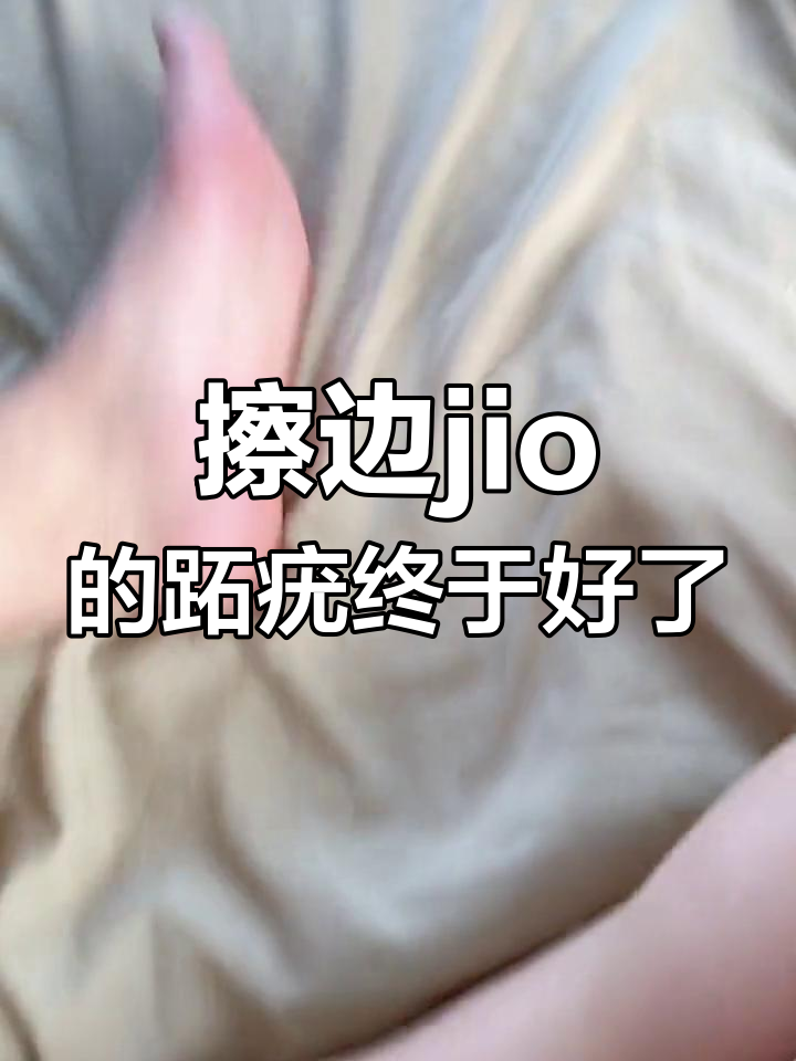 脚上的鸡眼原来是跖疣,掉了之后超轻松!