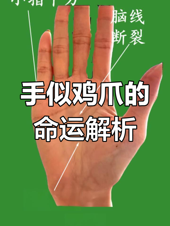 木型手如鸡爪,聪明却多思虑!