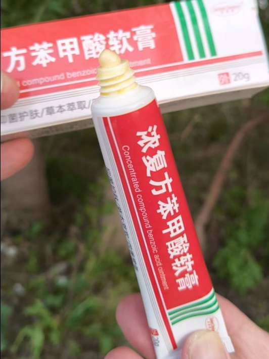 日常分享 复方苯甲酸软膏 大数据推荐给有需要的人 乳膏推荐